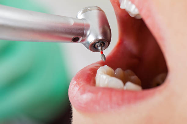 Best Emergency Orthodontic Repairs in Cottonport, LA